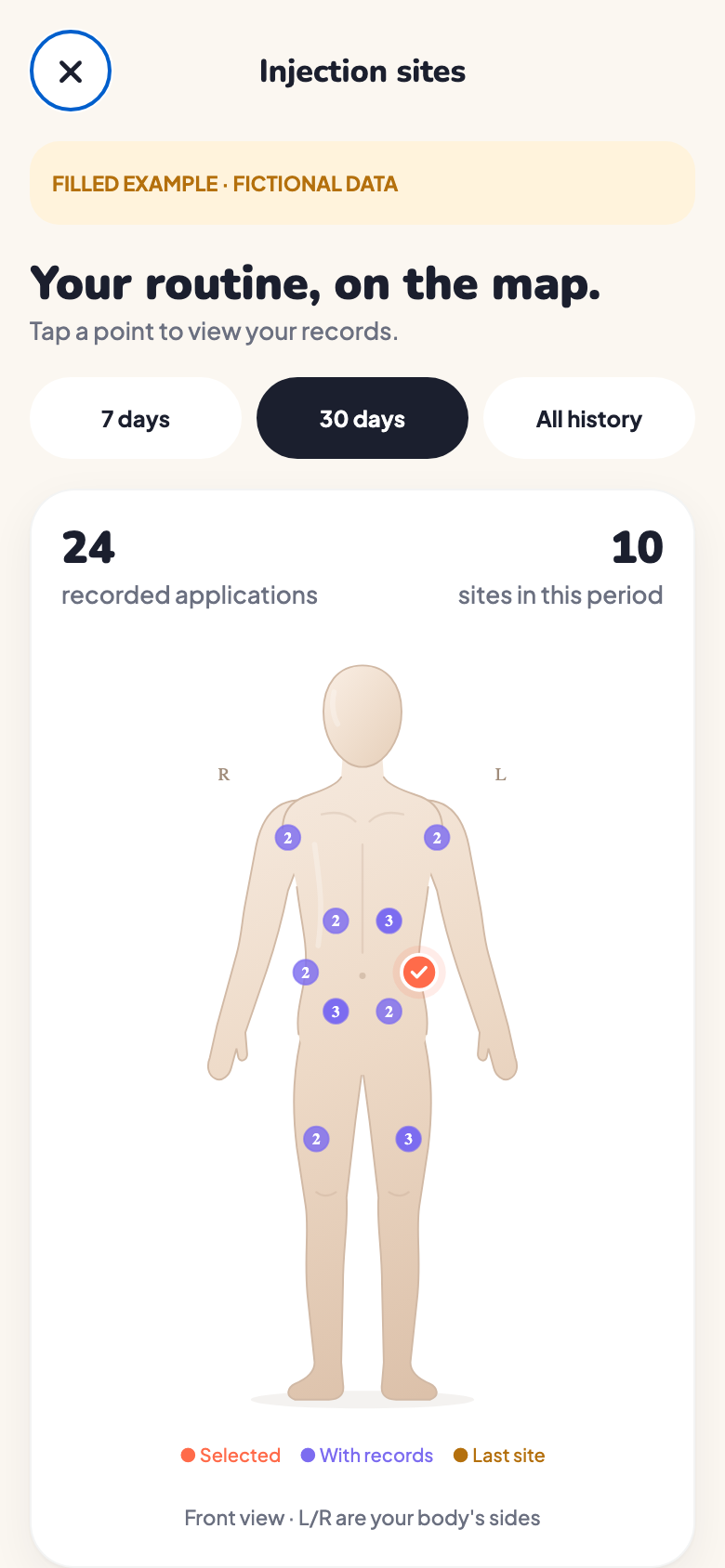 PepWay body map with sample application sites and entry counts.