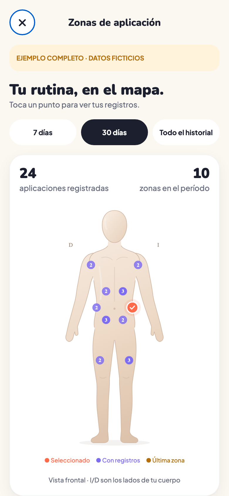 Mapa corporal de PepWay con lugares de aplicación y recuentos de ejemplo.