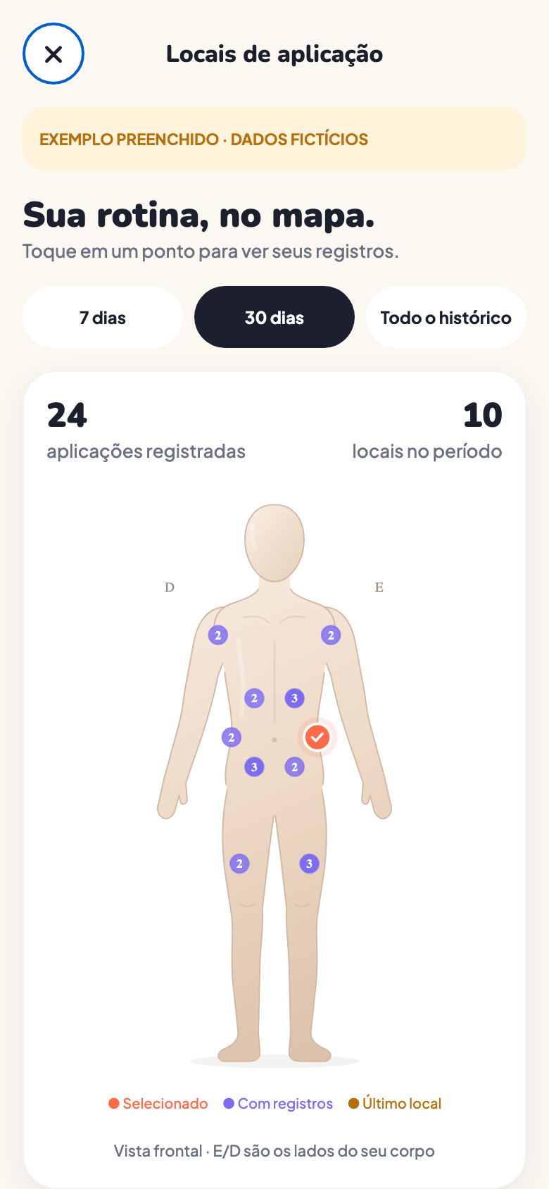 Mapa corporal do PepWay com locais de aplicação e contagens de exemplo.